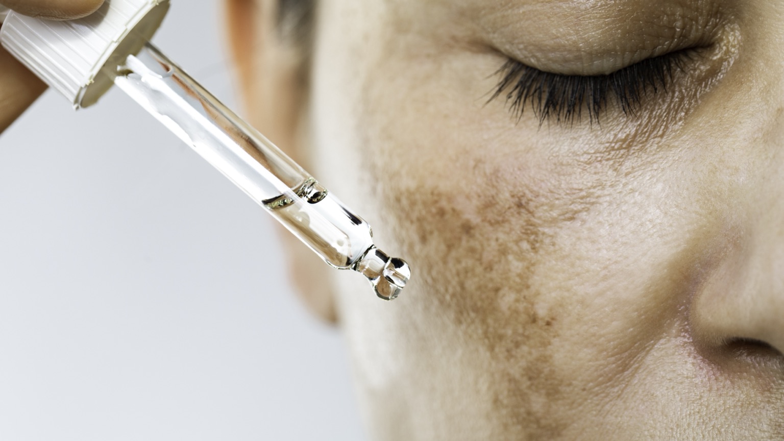Skin with visible dark spots and uneven tone