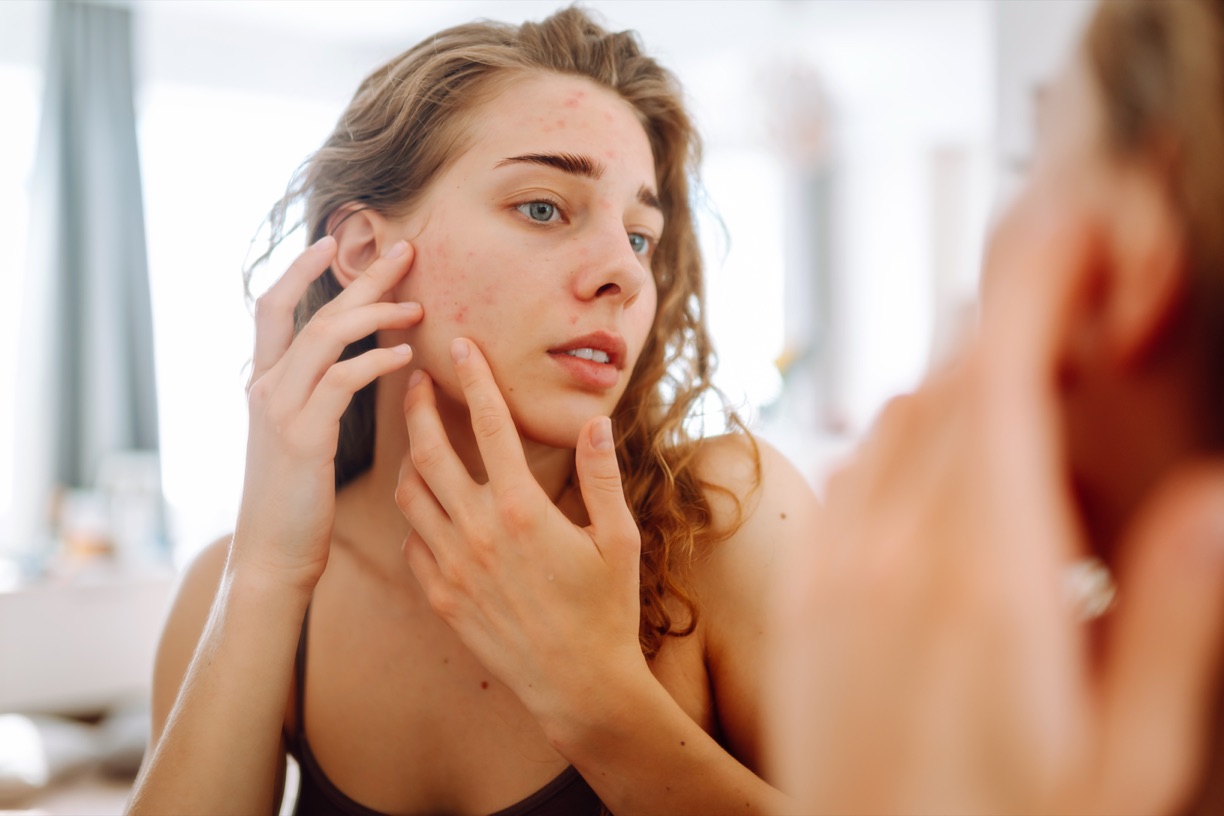 Sensitive skin with visible redness